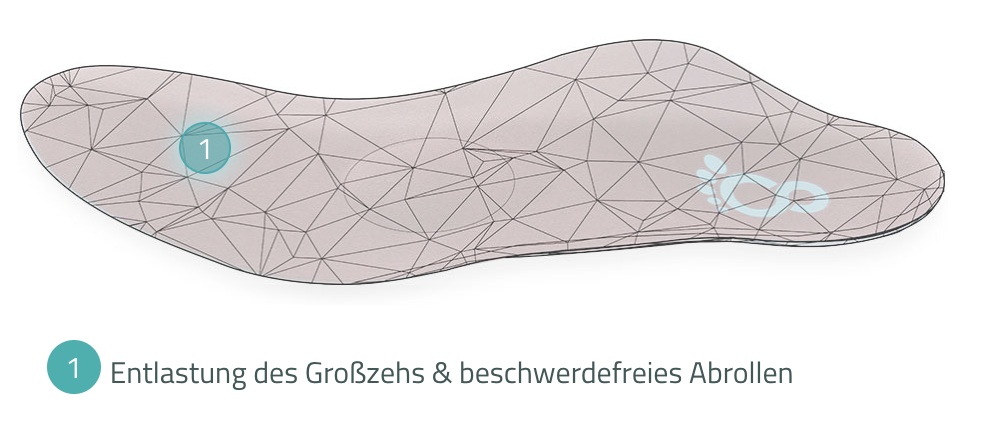 Custom orthopaedic insole by Cordewener for hallux rigidus, relieving the big toe joint
