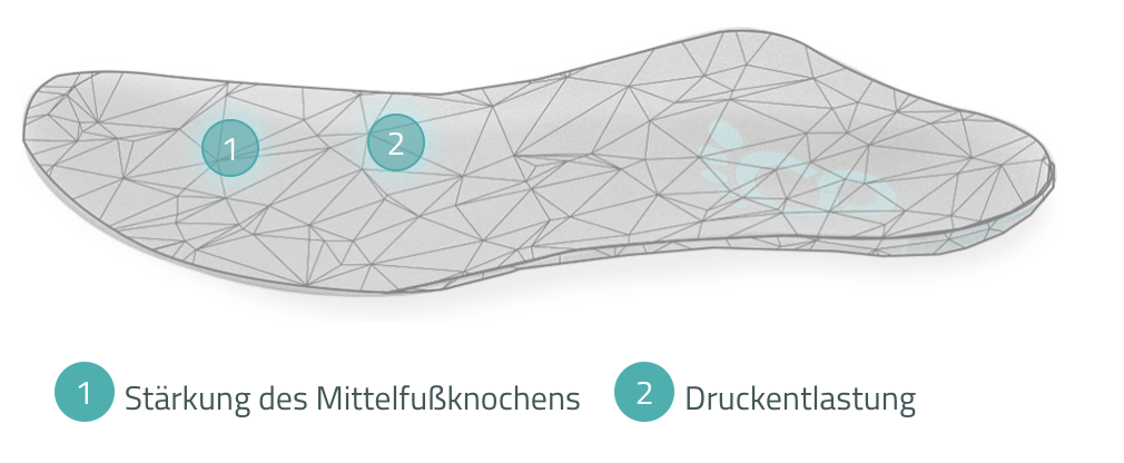 Custom orthopaedic insole by Cordewener for hallux valgus, relieving pressure on the metatarsal bone