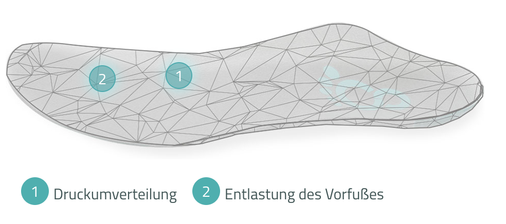 Orthopädische Masseinlage von Cordewener bei Metatarsalgie und Morton-Neuralgie zur Entlastung des Vorfusses